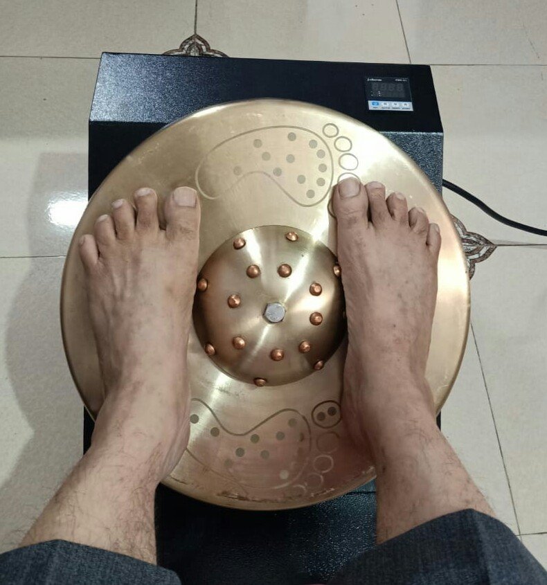 Acupuncture